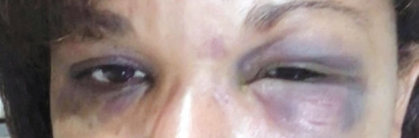 Justiça condena agressores de mulher a aula de respeito