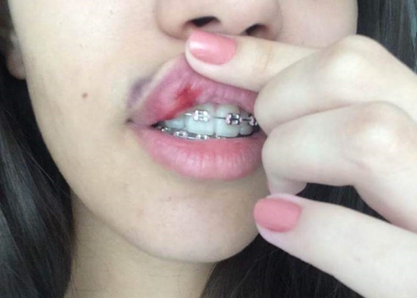 Filha de prefeito diz que surra deixou marcas por dentro e por fora